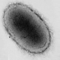 Akkermansia muciniphila and diabetes